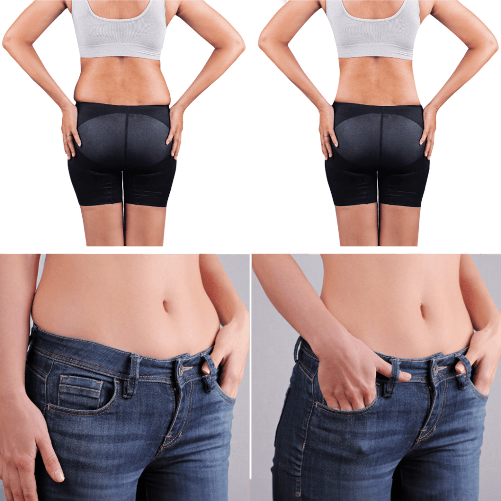 Fat Dissolve Injections in Stuart & Delray Beach, FL | Non-Surgical Fat ...